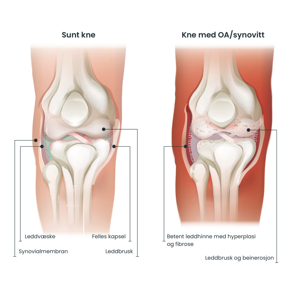 Knee compare no